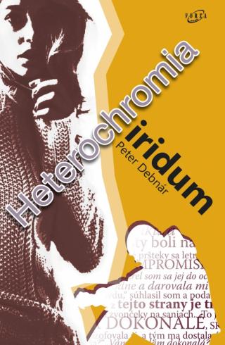 HETEROCHROMIA IRIDIUM