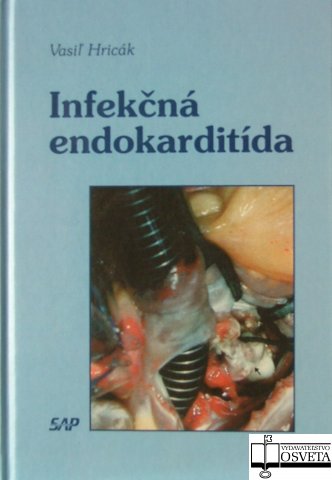 INFEKCNA ENDOKARDITIDA