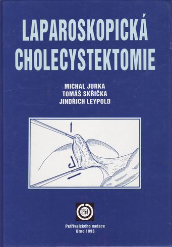 LAPAROSKOPICKA CHOLECYSTEKTOMIE