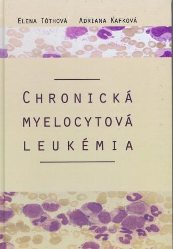 CHRONICKA MYELOCYTOVA LEUKEMIA